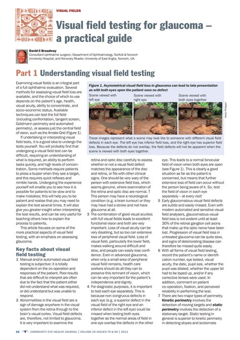 Visual field testing for glaucoma – a practical guide .